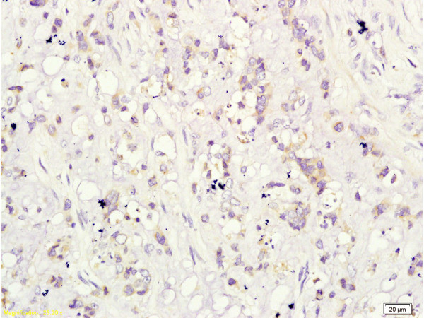CD160/By55 Antibody in Immunohistochemistry (Paraffin) (IHC (P))