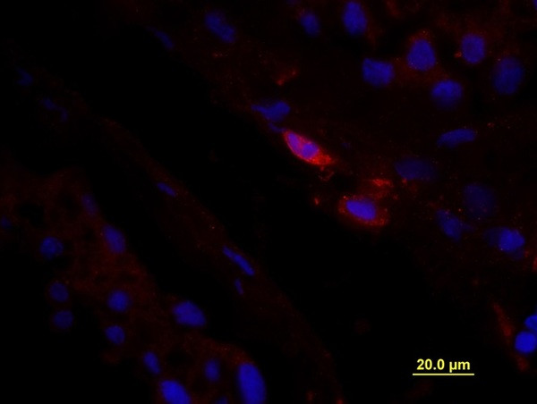 CD163/M130 Antibody in Immunohistochemistry (Paraffin) (IHC (P))