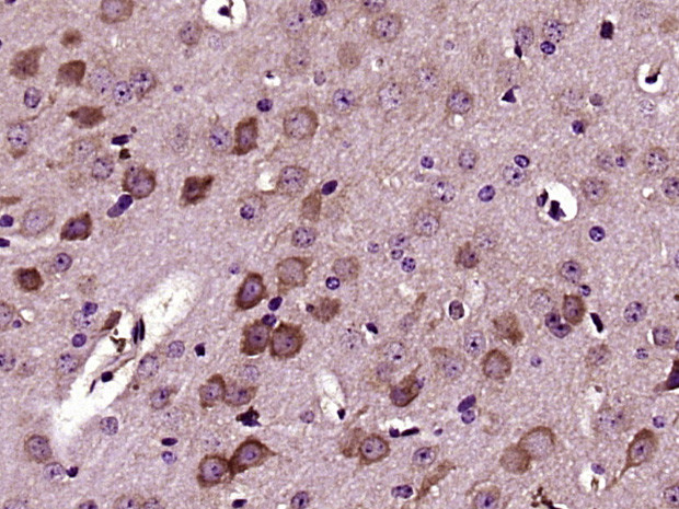 Versican Antibody in Immunohistochemistry (Paraffin) (IHC (P))