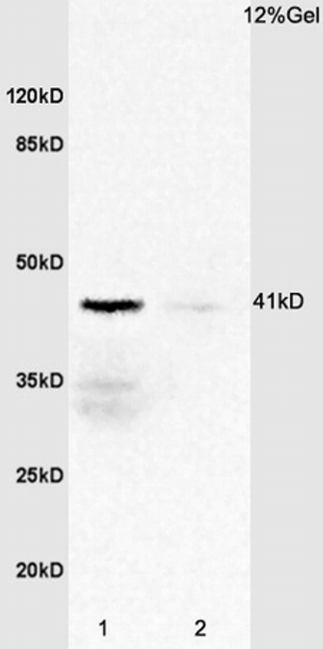 IL-2R gamma Antibody in Western Blot (WB)