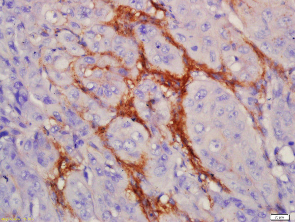 EGFRv3 Antibody in Immunohistochemistry (Paraffin) (IHC (P))