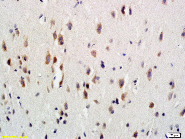 G-CSFR Antibody in Immunohistochemistry (Paraffin) (IHC (P))
