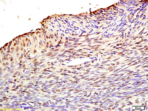 Fbx32 Antibody in Immunohistochemistry (Paraffin) (IHC (P))