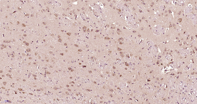 IL22RA2 Antibody in Immunohistochemistry (Paraffin) (IHC (P))