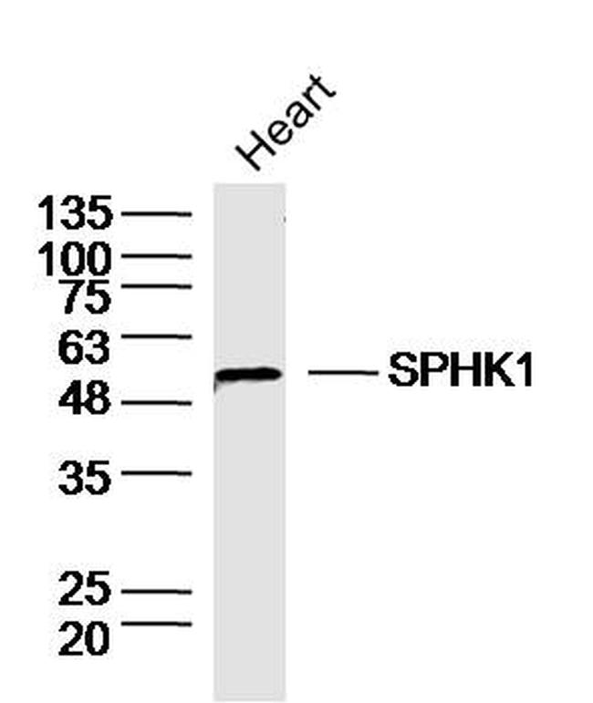 SPHK1 Antibody in Western Blot (WB)