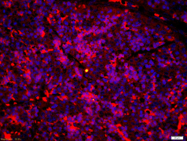 LTB4-R1/BLTR Antibody in Immunohistochemistry (Paraffin) (IHC (P))