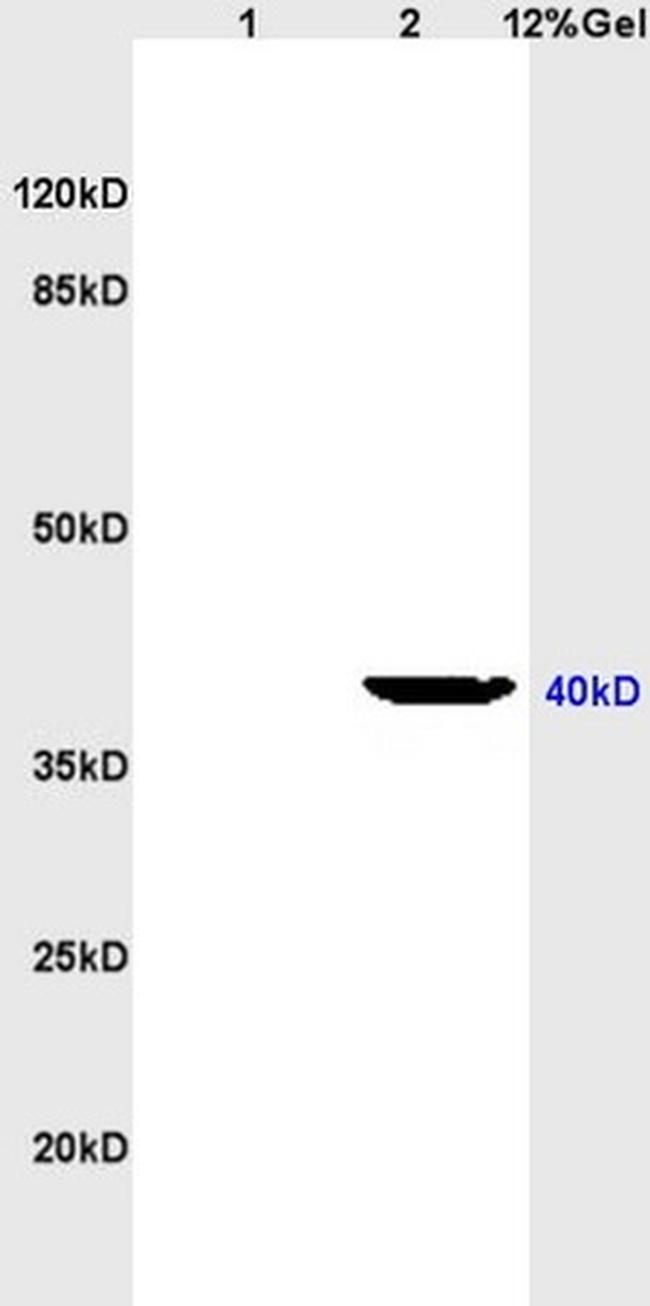 LTB4-R2 Antibody in Western Blot (WB)