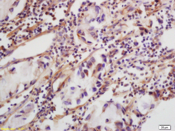 CLEC5A Antibody in Immunohistochemistry (Paraffin) (IHC (P))