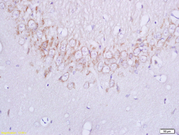 Plexin B1 Antibody in Immunohistochemistry (Paraffin) (IHC (P))