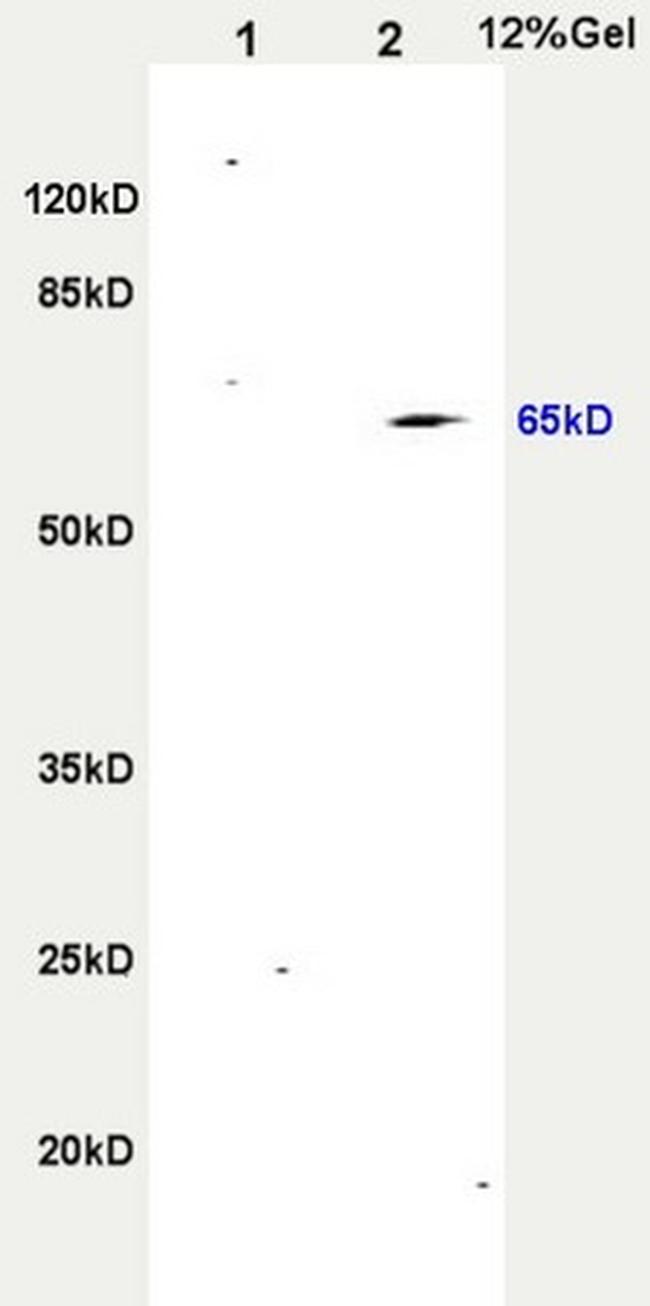 CD265 Antibody in Western Blot (WB)