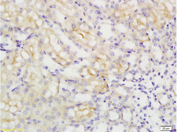MCT4 Antibody in Immunohistochemistry (Paraffin) (IHC (P))