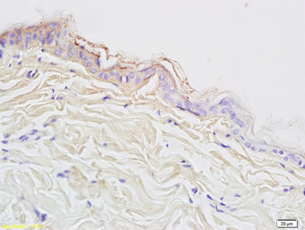 Cytokeratin 10 Antibody in Immunohistochemistry (Paraffin) (IHC (P))
