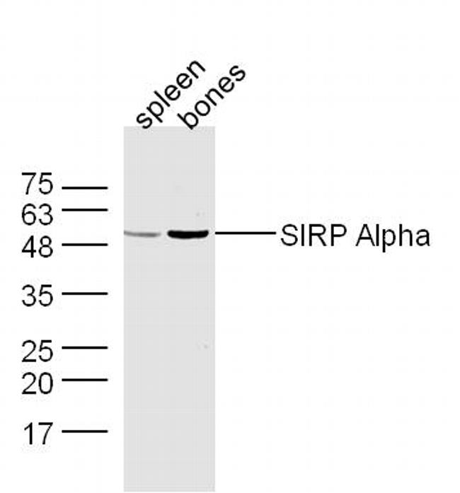 SIRP Alpha Antibody in Western Blot (WB)