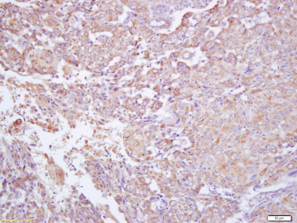 NGR2 Antibody in Immunohistochemistry (Paraffin) (IHC (P))
