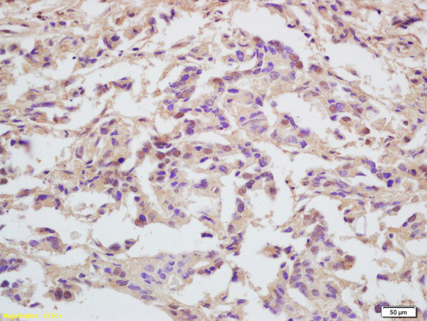 MCM5 Antibody in Immunohistochemistry (Paraffin) (IHC (P))