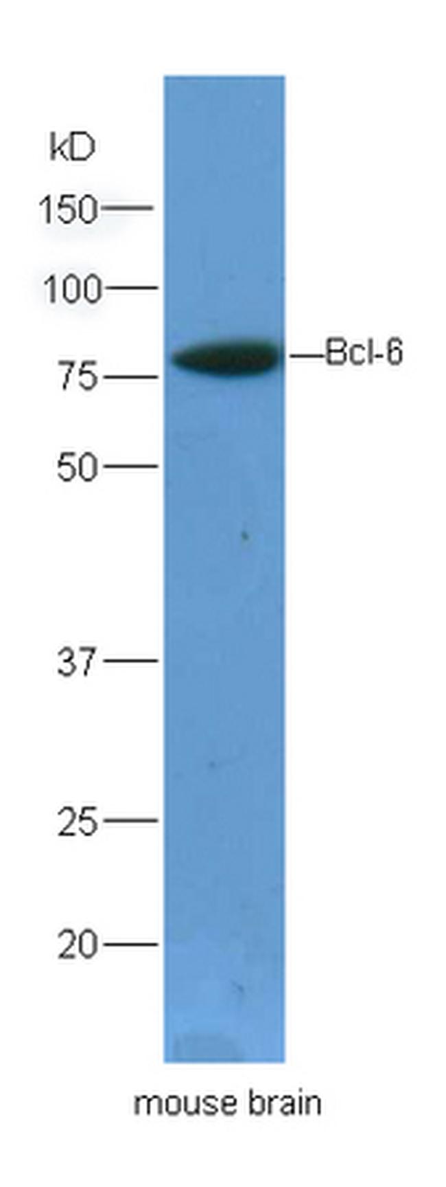 Bcl6 Antibody in Western Blot (WB)