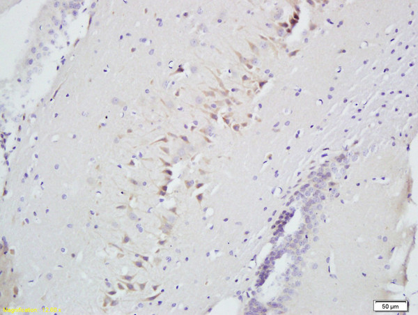 SLIT2/Slil3 Antibody in Immunohistochemistry (Paraffin) (IHC (P))