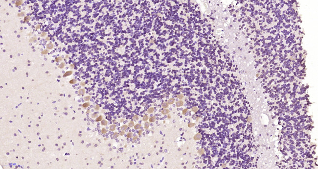 Bcr Antibody in Immunohistochemistry (Paraffin) (IHC (P))