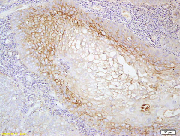 MCSF Receptor Antibody in Immunohistochemistry (Paraffin) (IHC (P))