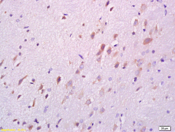 DARPP32 Antibody in Immunohistochemistry (Paraffin) (IHC (P))