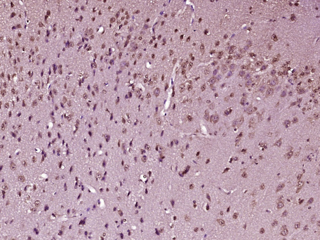 FOXO1 + FOXO4 Antibody in Immunohistochemistry (Paraffin) (IHC (P))