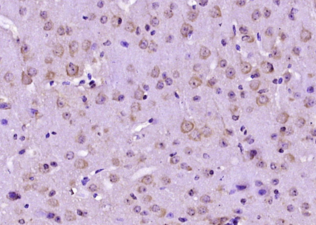 GRB10 Antibody in Immunohistochemistry (Paraffin) (IHC (P))