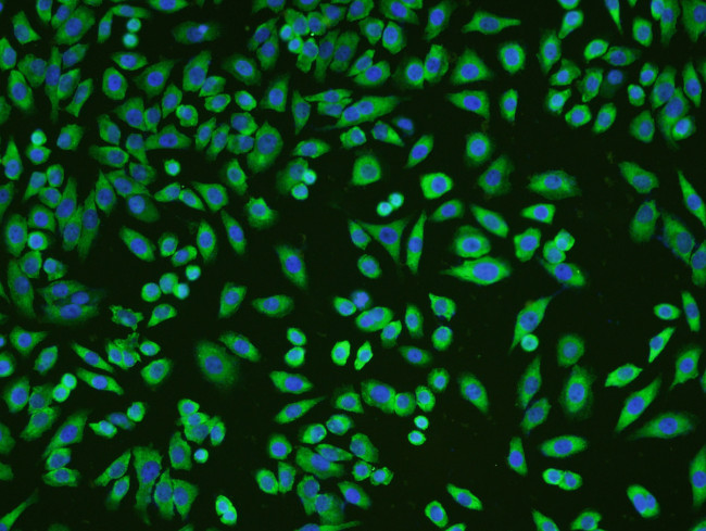 KLF2 Antibody in Immunocytochemistry (ICC/IF)