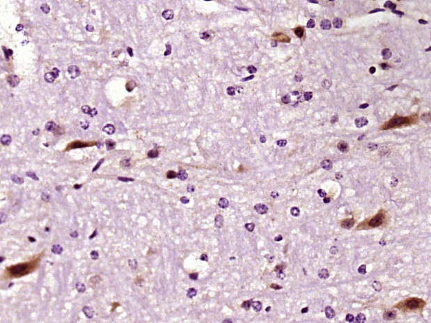 LIMK1 Antibody in Immunohistochemistry (Paraffin) (IHC (P))