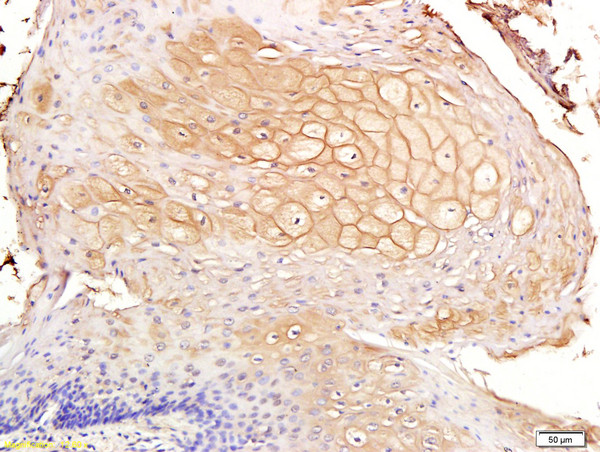 CD44v7 Antibody in Immunohistochemistry (Paraffin) (IHC (P))