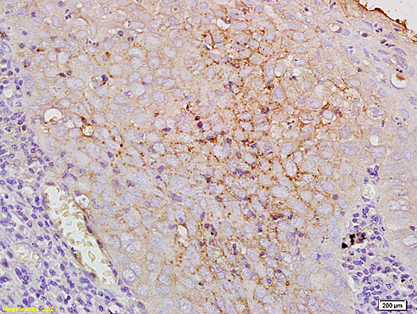 CD44v10 Antibody in Immunohistochemistry (Paraffin) (IHC (P))