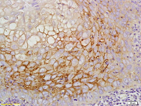 CD44RC Antibody in Immunohistochemistry (Paraffin) (IHC (P))