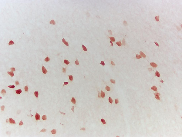 LMP2 Antibody in Immunohistochemistry (Paraffin) (IHC (P))