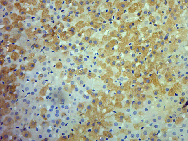 RET Antibody in Immunohistochemistry (Paraffin) (IHC (P))