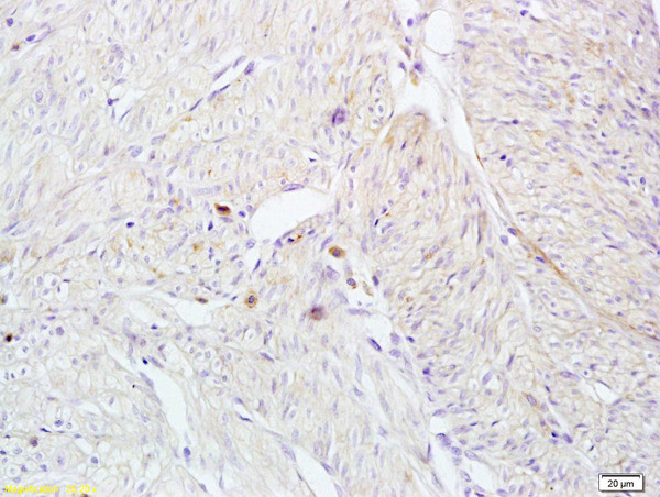 CD161 Antibody in Immunohistochemistry (Paraffin) (IHC (P))