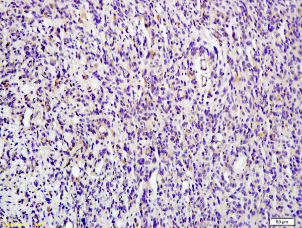HDAC4 Antibody in Immunohistochemistry (Paraffin) (IHC (P))