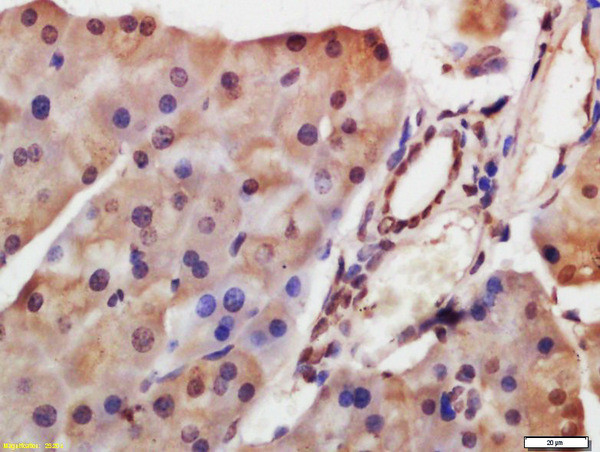 HDAC8 Antibody in Immunohistochemistry (Paraffin) (IHC (P))