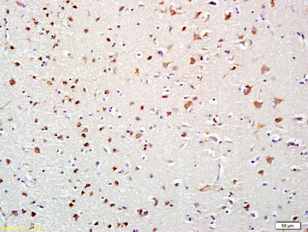 HDAC10 Antibody in Immunohistochemistry (Paraffin) (IHC (P))