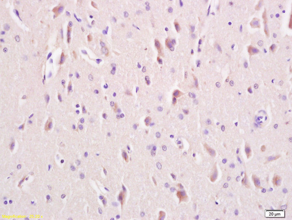 LRP5/LRP6 Antibody in Immunohistochemistry (Paraffin) (IHC (P))