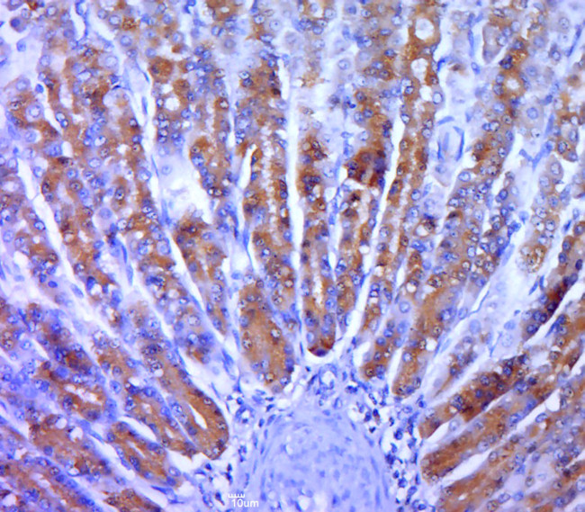 MAPKAP Kinase 2 Antibody in Immunohistochemistry (Paraffin) (IHC (P))