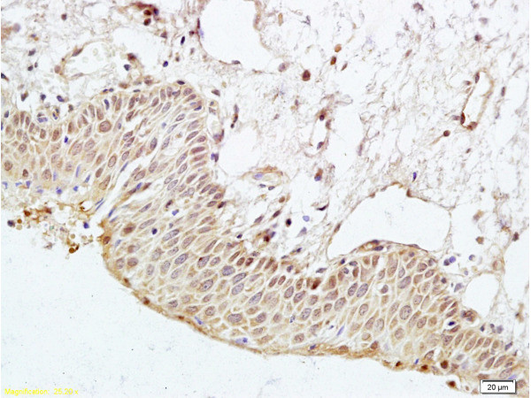 PARD-3 Antibody in Immunohistochemistry (Paraffin) (IHC (P))
