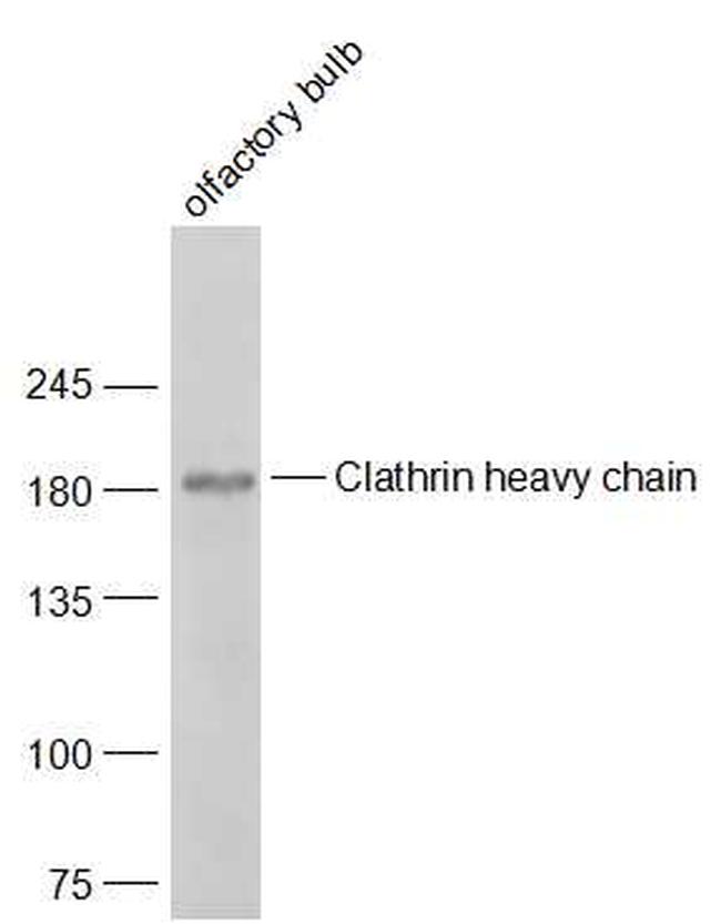 Clathrin heavy chain Antibody in Western Blot (WB)