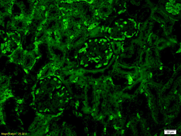 Complement C3 Antibody in Immunohistochemistry (Paraffin) (IHC (P))