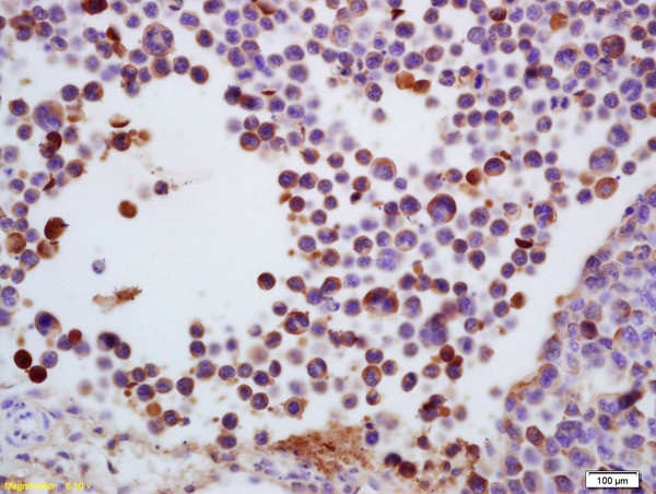 TdT Antibody in Immunohistochemistry (Paraffin) (IHC (P))