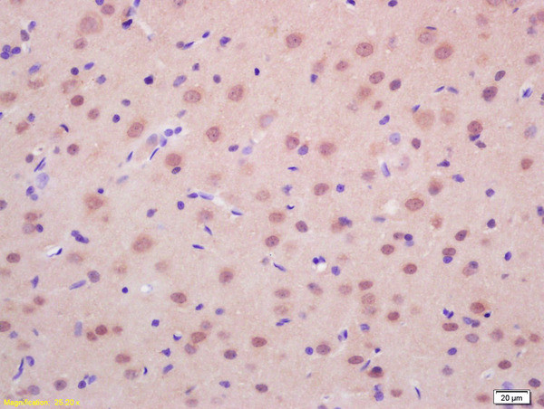 RASSF2 Antibody in Immunohistochemistry (Paraffin) (IHC (P))