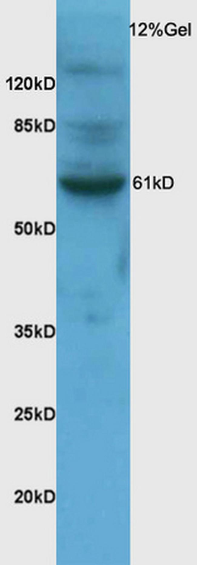 SNX1 Antibody in Western Blot (WB)