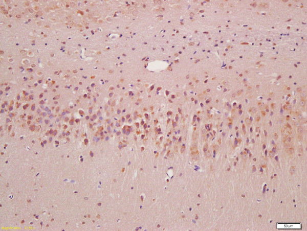 SQSTM1 Antibody in Immunohistochemistry (Paraffin) (IHC (P))
