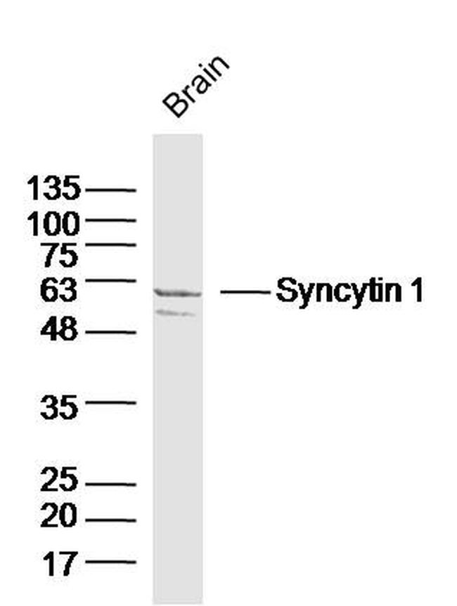 Syncytin 1 Antibody in Western Blot (WB)