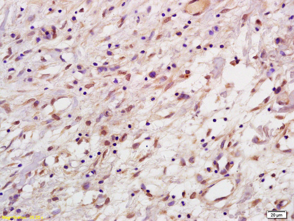 HPV33 E7 Antibody in Immunohistochemistry (Paraffin) (IHC (P))