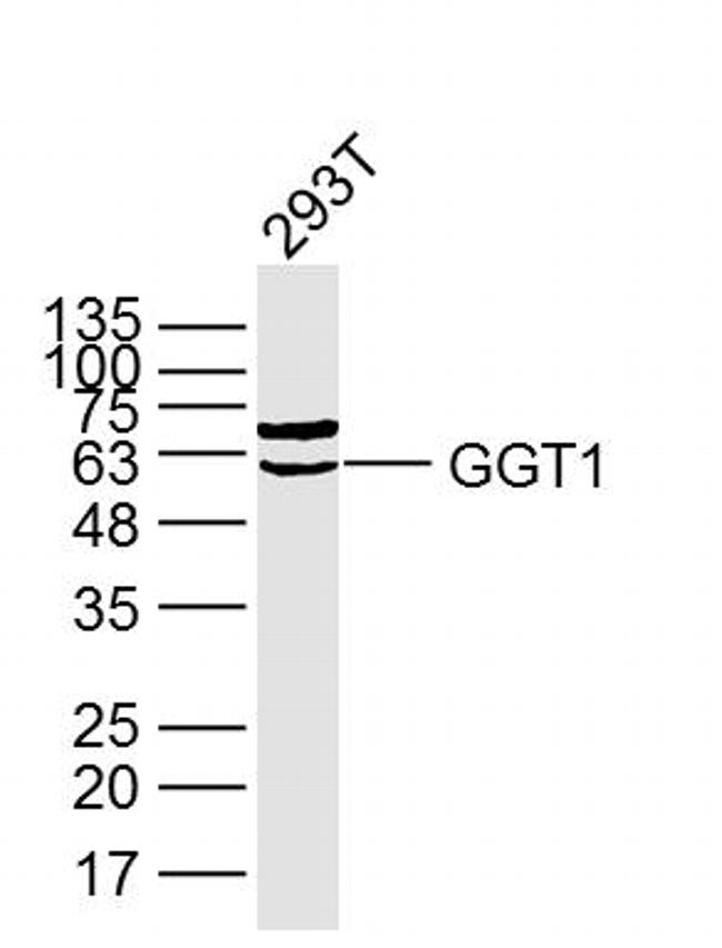 GGT1 Antibody in Western Blot (WB)