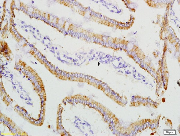 ADM2 Antibody in Immunohistochemistry (Paraffin) (IHC (P))